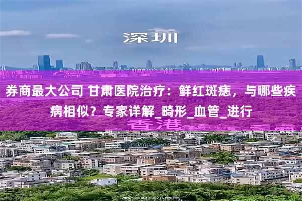 券商最大公司 甘肃医院治疗：鲜红斑痣，与哪些疾病相似？专家详解_畸形_血管_进行